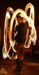 BuRn ViCtImS2